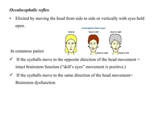 Occulocephalic reflex
• Elicited by moving the head from side to side or vertically with eyes held
open.
In comatose patient:-
 If the eyeballs move to the opposite direction of the head movement =
intact brainstem function (“doll’s eyes” movement is positive.)
 If the eyeballs move to the same direction of the head movement=
Brainstem dysfunction
 