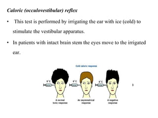 Caloric (occulovestibular) reflex
• This test is performed by irrigating the ear with ice (cold) to
stimulate the vestibular apparatus.
• In patients with intact brain stem the eyes move to the irrigated
ear.
 
