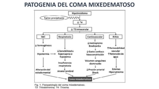 PATOGENIA DEL COMA MIXEDEMATOSO
 