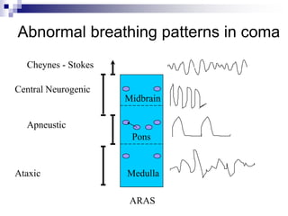 Abnormal breathing patterns in coma
Midbrain
Pons
Medulla
ARAS
Cheynes - Stokes
Ataxic
Apneustic
Central Neurogenic
 