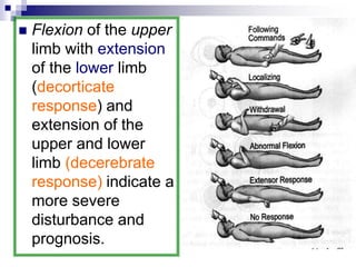  Flexion of the upper
limb with extension
of the lower limb
(decorticate
response) and
extension of the
upper and lower
limb (decerebrate
response) indicate a
more severe
disturbance and
prognosis.
 
