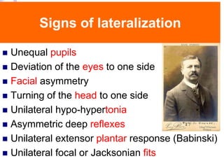 Signs of lateralization
 Unequal pupils
 Deviation of the eyes to one side
 Facial asymmetry
 Turning of the head to one side
 Unilateral hypo-hypertonia
 Asymmetric deep reflexes
 Unilateral extensor plantar response (Babinski)
 Unilateral focal or Jacksonian fits
 
