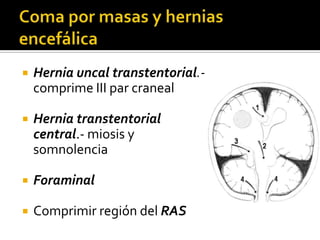 Coma por masas y hernias encefálicaHernia uncaltranstentorial.- comprime III par cranealHernia transtentorial central.- miosis y somnolenciaForaminalComprimir región del RAS