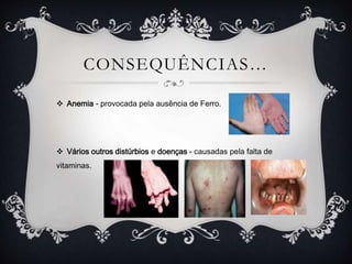 CONSEQUÊNCIAS…
 Anemia - provocada pela ausência de Ferro.
 Vários outros distúrbios e doenças - causadas pela falta de
vitaminas.
 