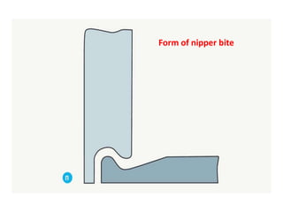 Form of nipper bite
 
