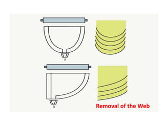 Removal of the Web
 