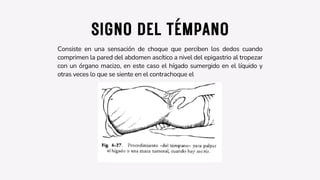 SIGNO DEL TÉMPANO
Consiste en una sensación de choque que perciben los dedos cuando
comprimen la pared del abdomen ascítico a nivel del epigastrio al tropezar
con un órgano macizo, en este caso el hígado sumergido en el líquido y
otras veces lo que se siente en el contrachoque el
 