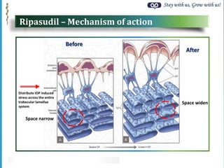 Stay with us, Grow with us!
Space narrow
Space widen
Distribute IOP induced
stress across the entire
trabecular lamellae
system
Before
After
Ripasudil – Mechanism of action
 