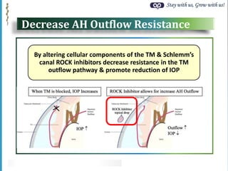 Stay with us, Grow with us!
Decrease AH Outflow Resistance
By altering cellular components of the TM & Schlemm’s
canal ROCK inhibitors decrease resistance in the TM
outflow pathway & promote reduction of IOP
 