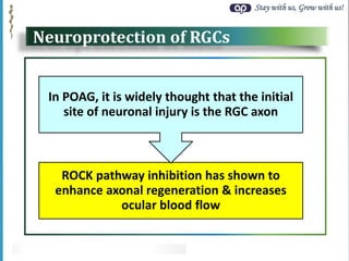 Stay with us, Grow with us!
Neuroprotection of RGCs
ROCK pathway inhibition has shown to
enhance axonal regeneration & increases
ocular blood flow
In POAG, it is widely thought that the initial
site of neuronal injury is the RGC axon
Primary OAG: POAG
 