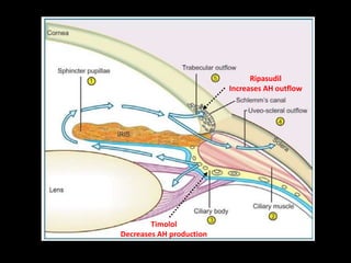 22
Ripasudil
Increases AH outflow
Timolol
Decreases AH production
 