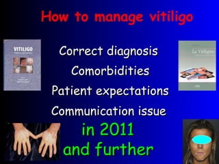 How to manage vitiligo Correct diagnosis  Comorbidities Patient expectations Communication issue   in 2011  and further   