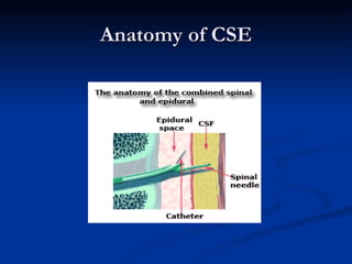 Combined Spinal Epidural Anesthesia | PPT