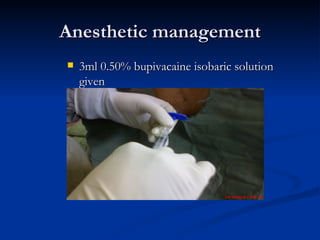 Anesthetic management <ul><li>3ml 0.50% bupivacaine isobaric solution given </li></ul>