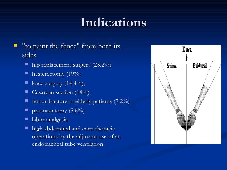 Combined Spinal Epidural Anesthesia