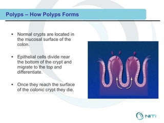 Colonic Crypt Polyp Combined 08 clinical training--pathology pre-malignant_colorectal ...