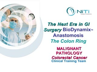 The Next Era in GI Surgery  BioDynamix TM Anastomosis The Colon Ring Clinical Training Team MALIGNANT PATHOLOGY Colorectal Cancer 