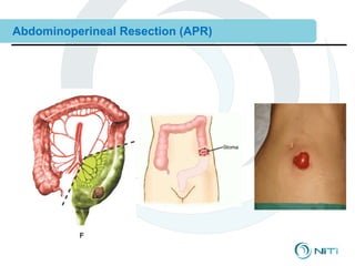 Combined 12 clinical training--surgical procedures | PPT