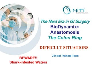 The Next Era in GI Surgery BioDynamixTM Anastomosis The Colon Ring DIFFICULT SITUATIONS Clinical Training Team BEWARE!! Shark-infested Waters 