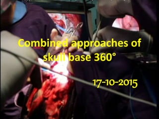 Combined approaches of
skull base 360°
26-6-2016
6.55 pm
 