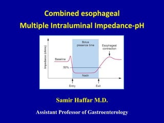 Combined esophageal
Multiple Intraluminal Impedance-pH
Samir Haffar M.D.
Assistant Professor of Gastroenterology
 