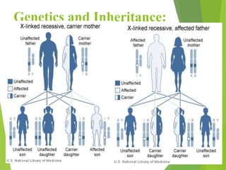 Scid Inheritance Combined immunodeficiencies (SCID).ppt. | PPTX