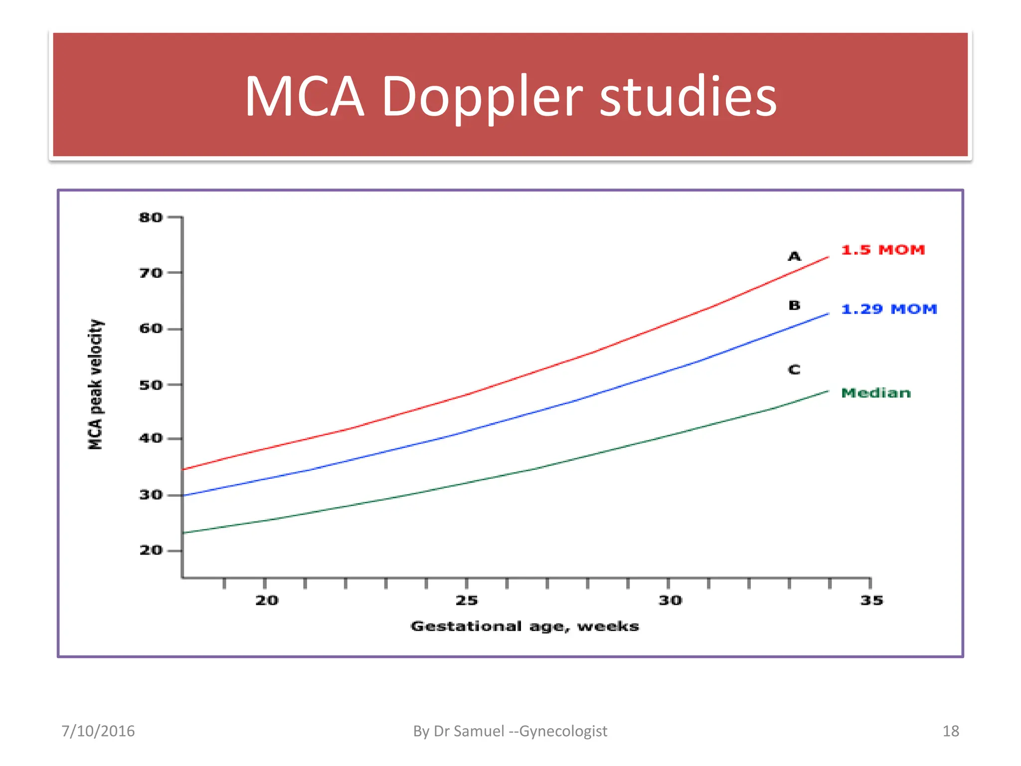 MCA Doppler studies
7/10/2016 By Dr Samuel --Gynecologist 18
 