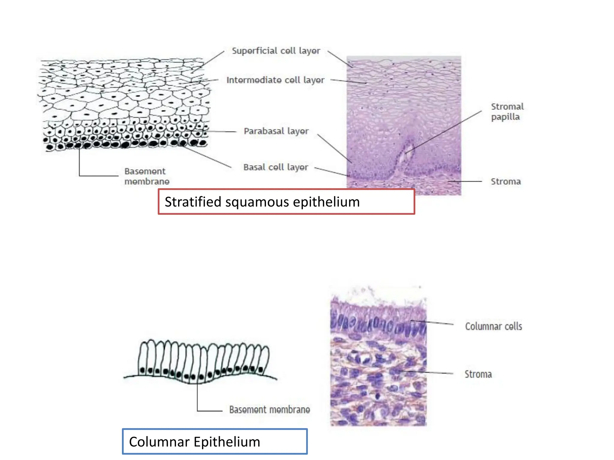 Columnar Epithelium
Stratified squamous epithelium
 