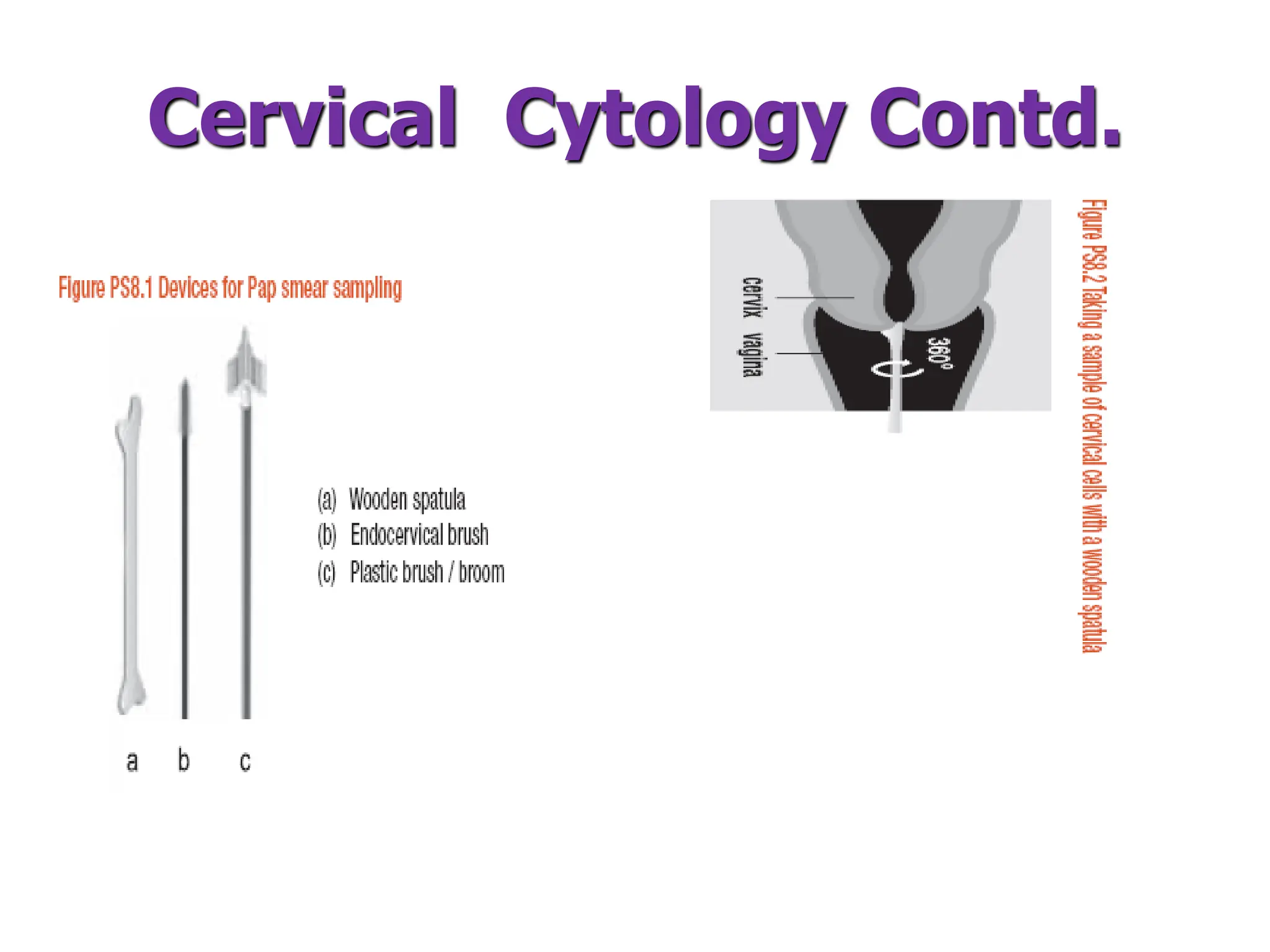 Cervical Cytology Contd.
 