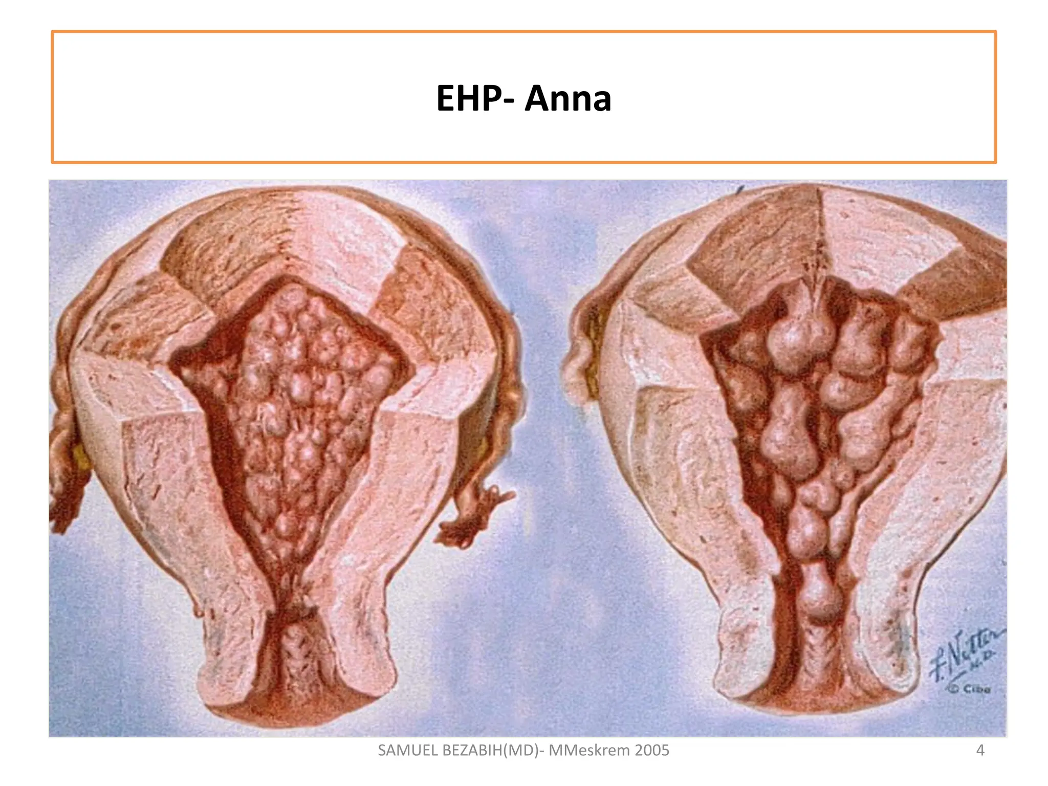 EHP- Anna
SAMUEL BEZABIH(MD)- MMeskrem 2005 4
 