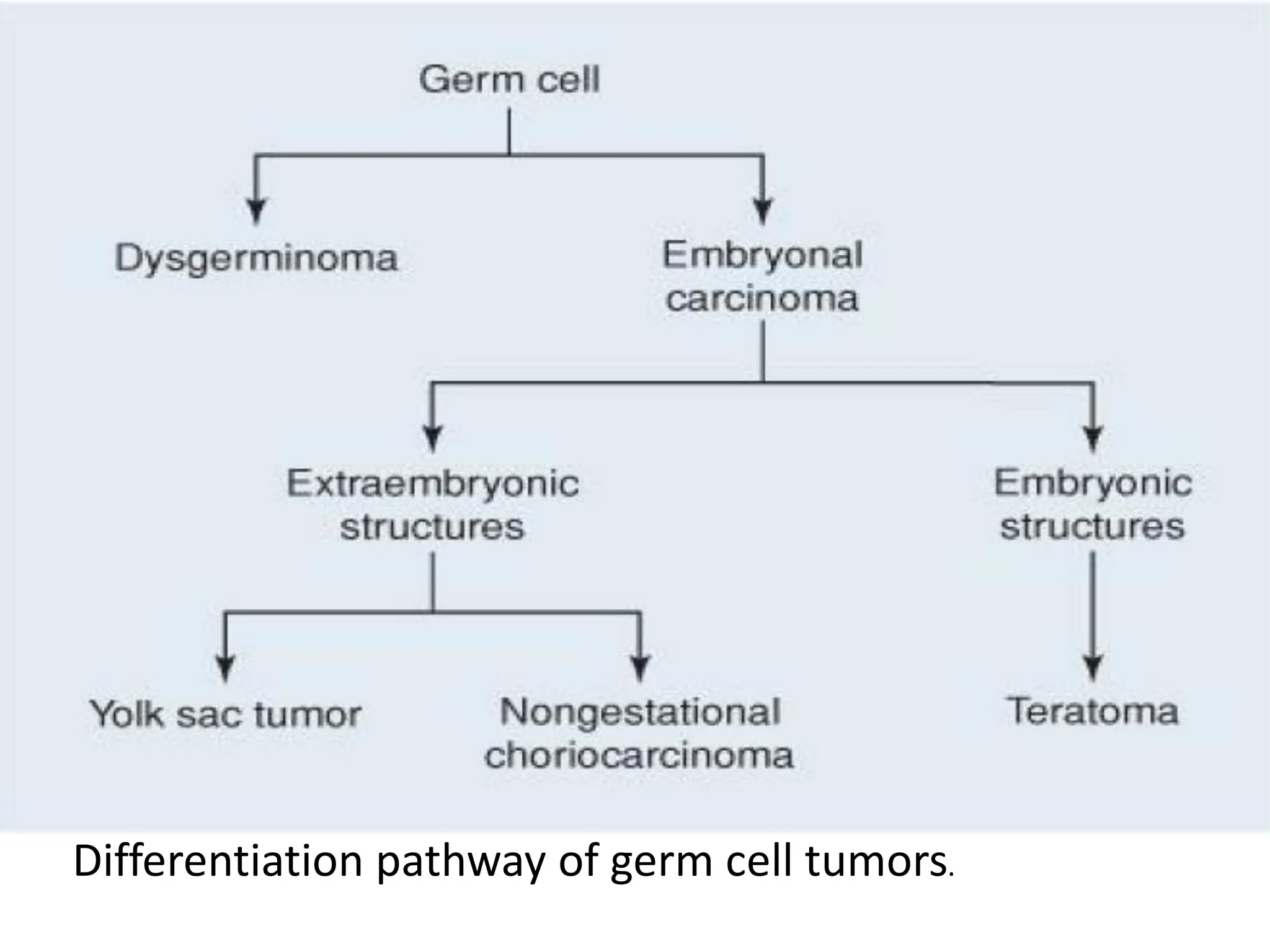 Differentiation pathway of germ cell tumors.
 
