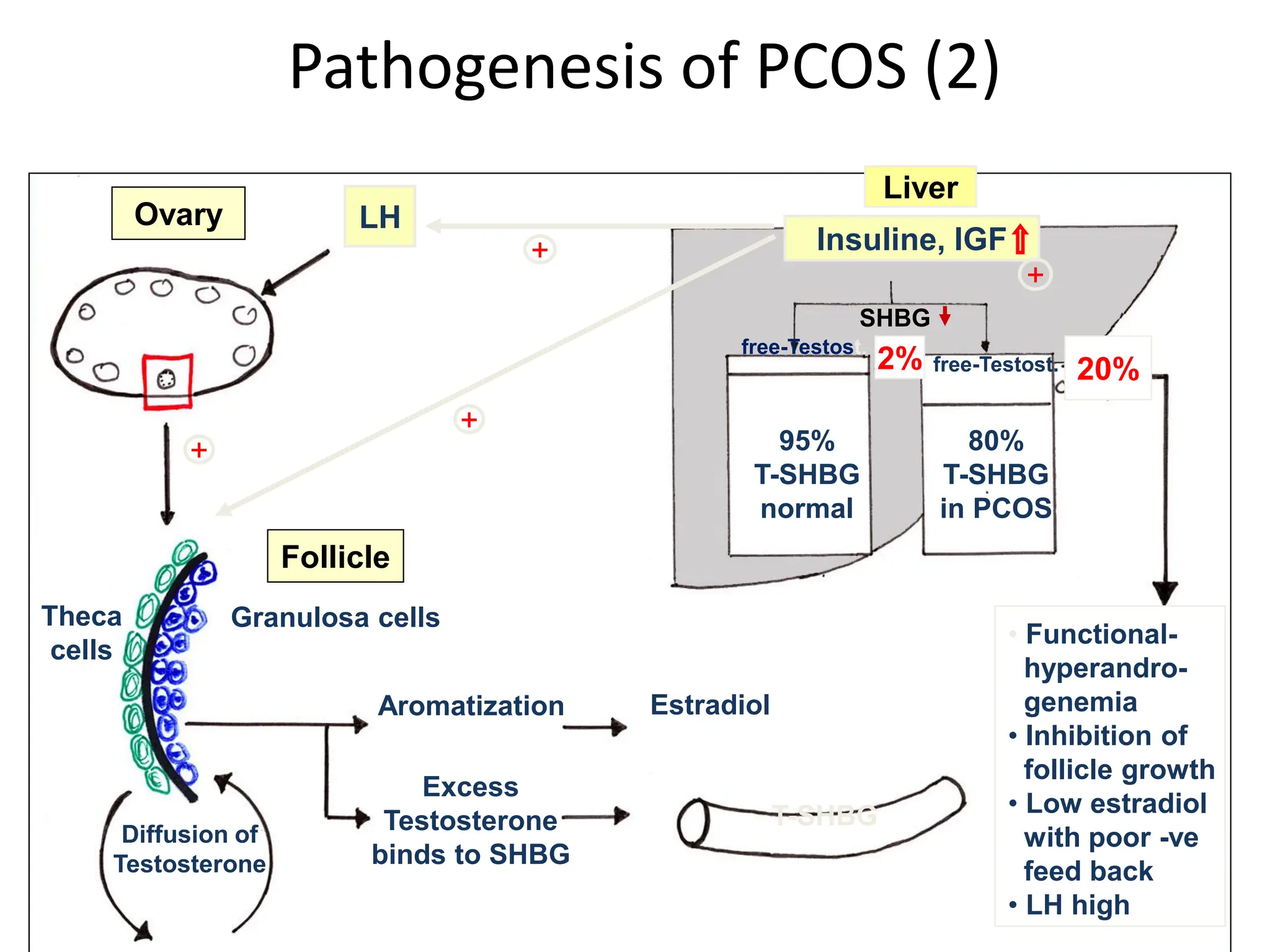 Pathogenesis of PCOS (2)
2 cell theory bild?
LH
Liver
Granulosa cells
Theca
cells
Diffusion of
Testosterone
Aromatization Estradiol
Excess
Testosterone
binds to SHBG
T-SHBG
2% 20%
95%
T-SHBG
normal
80%
T-SHBG
in PCOS
free-Testost.
free-Testost.
• Functional-
hyperandro-
genemia
• Inhibition of
follicle growth
• Low estradiol
with poor -ve
feed back
• LH high
Insuline, IGF
+
+
+
Ovary
Follicle
+
SHBG
 