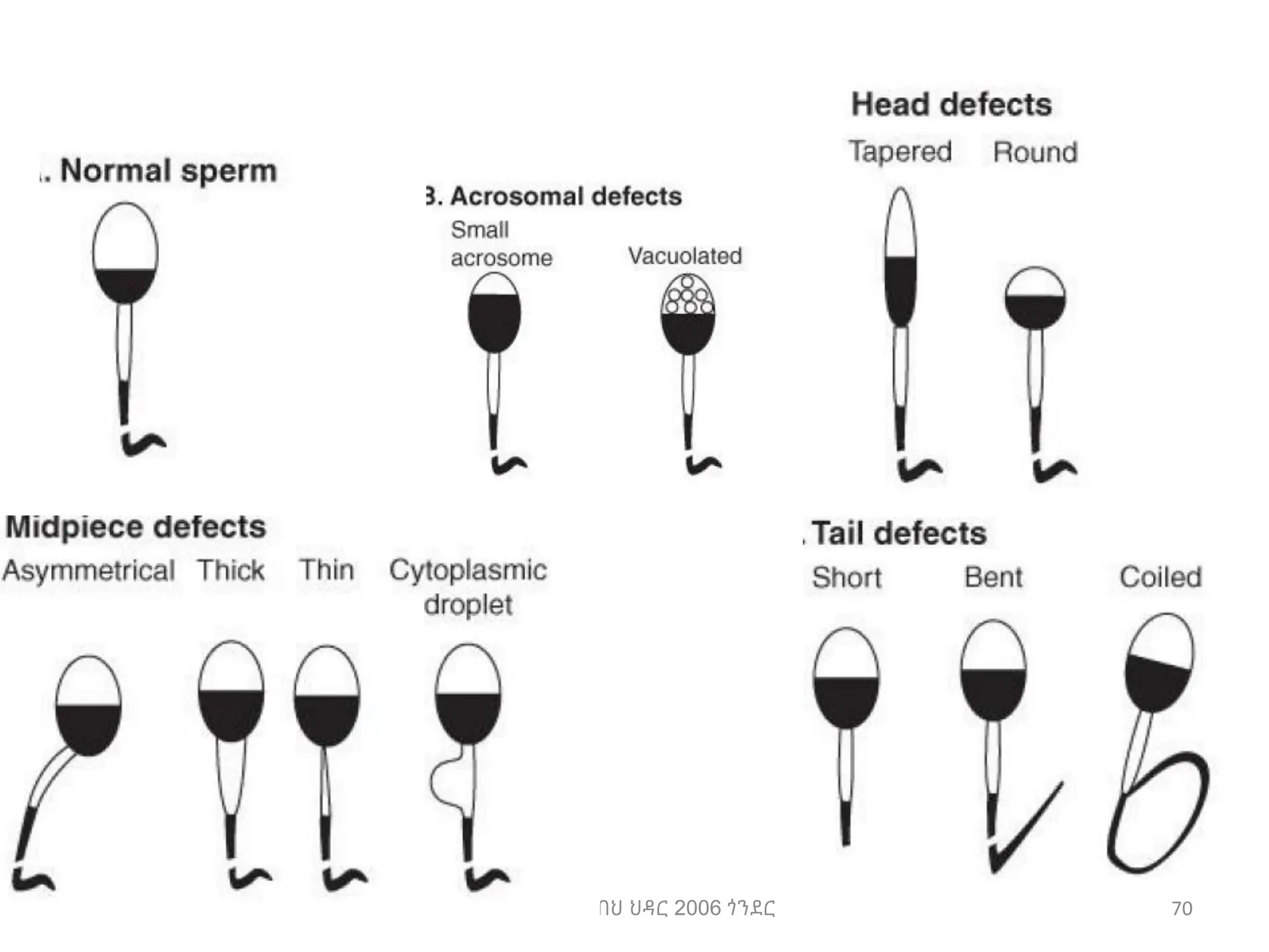 ሳሙኤል በዛብህ ህዳር 2006 ጎንደር 70
 