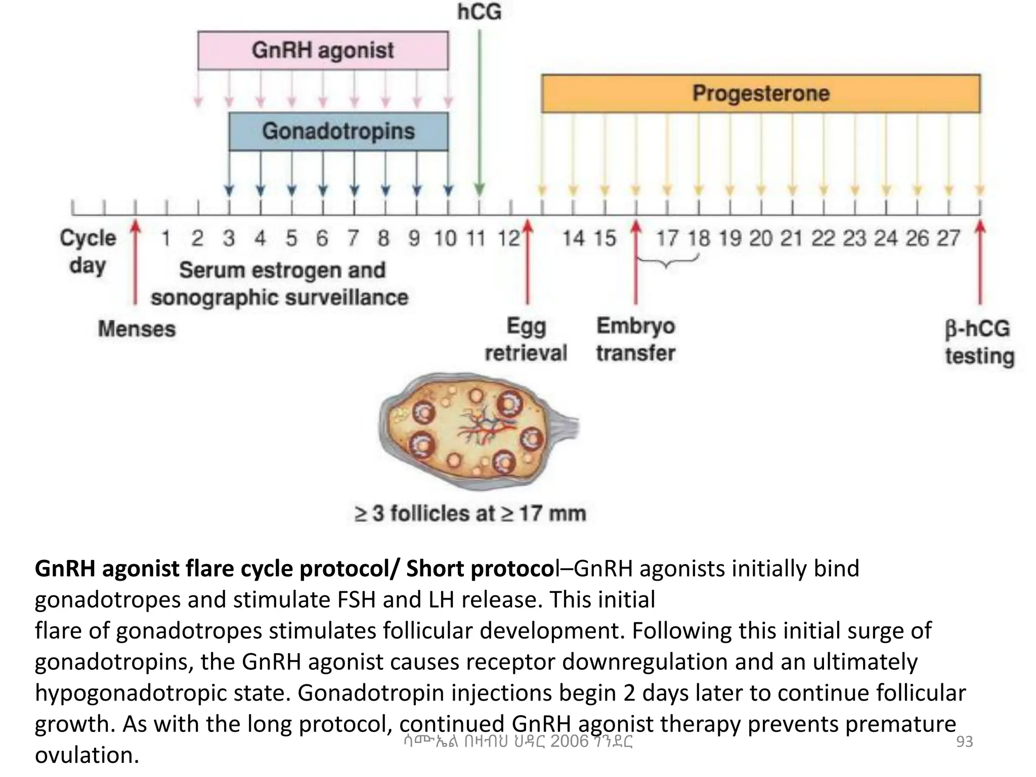 ሳሙኤል በዛብህ ህዳር 2006 ጎንደር 93
GnRH agonist flare cycle protocol/ Short protocol–GnRH agonists initially bind
gonadotropes and stimulate FSH and LH release. This initial
flare of gonadotropes stimulates follicular development. Following this initial surge of
gonadotropins, the GnRH agonist causes receptor downregulation and an ultimately
hypogonadotropic state. Gonadotropin injections begin 2 days later to continue follicular
growth. As with the long protocol, continued GnRH agonist therapy prevents premature
ovulation.
 
