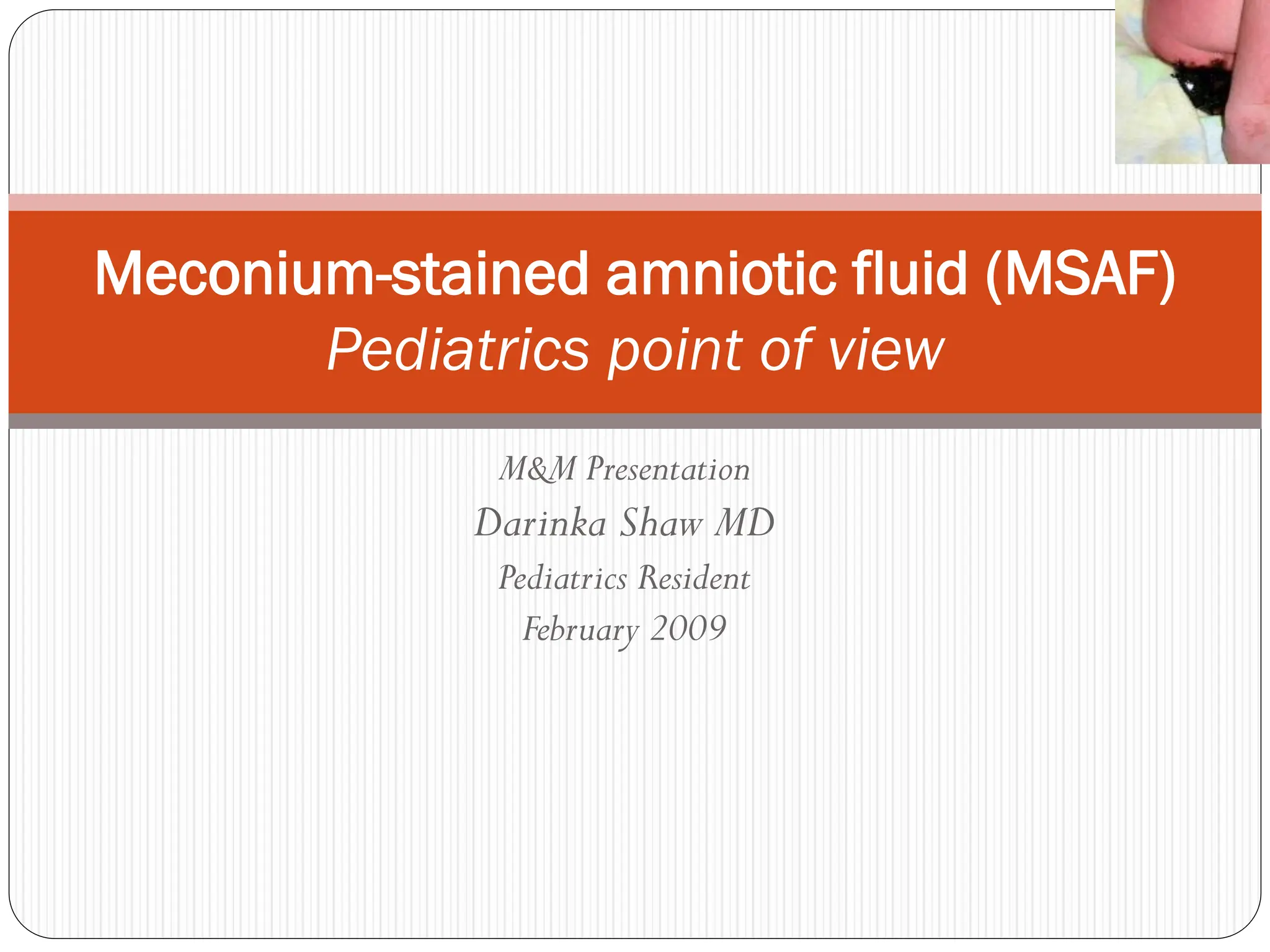 M&M Presentation
Darinka Shaw MD
Pediatrics Resident
February 2009
Meconium-stained amniotic fluid (MSAF)
Pediatrics point of view
 