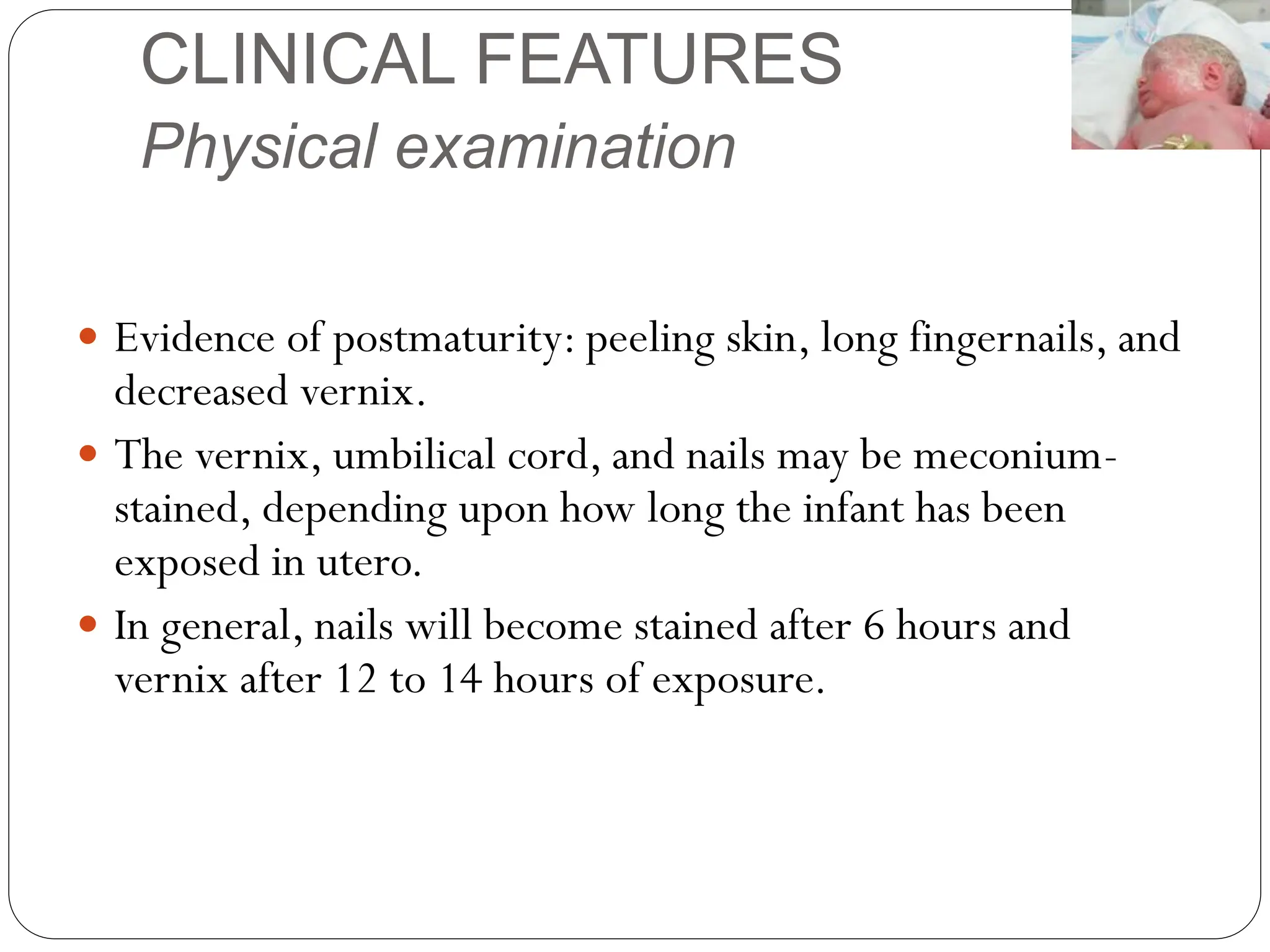 CLINICAL FEATURES
Physical examination
 Evidence of postmaturity: peeling skin, long fingernails, and
decreased vernix.
 The vernix, umbilical cord, and nails may be meconium-
stained, depending upon how long the infant has been
exposed in utero.
 In general, nails will become stained after 6 hours and
vernix after 12 to 14 hours of exposure.
 