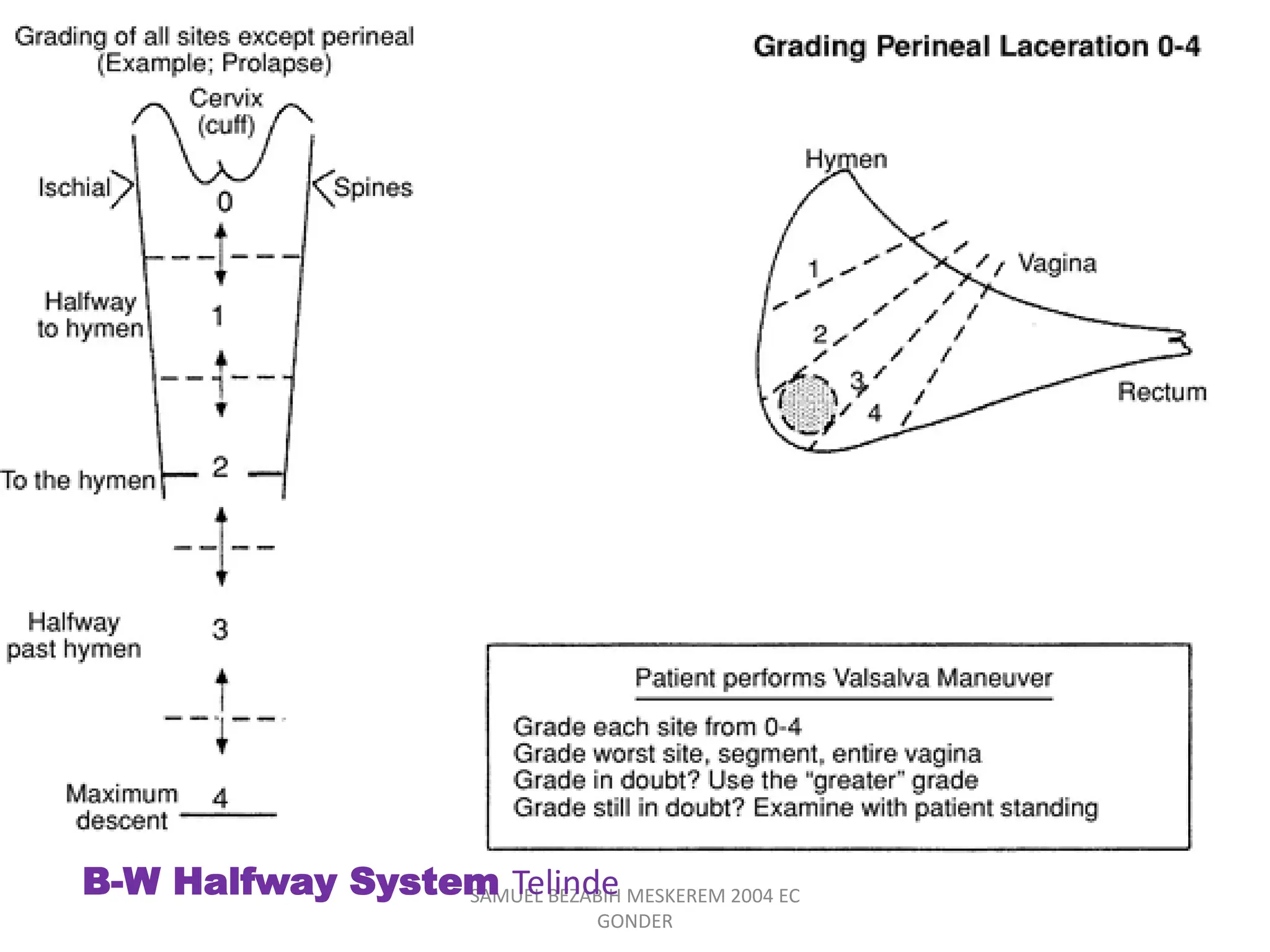 SAMUEL BEZABIH MESKEREM 2004 EC
GONDER
B-W Halfway System Telinde
 
