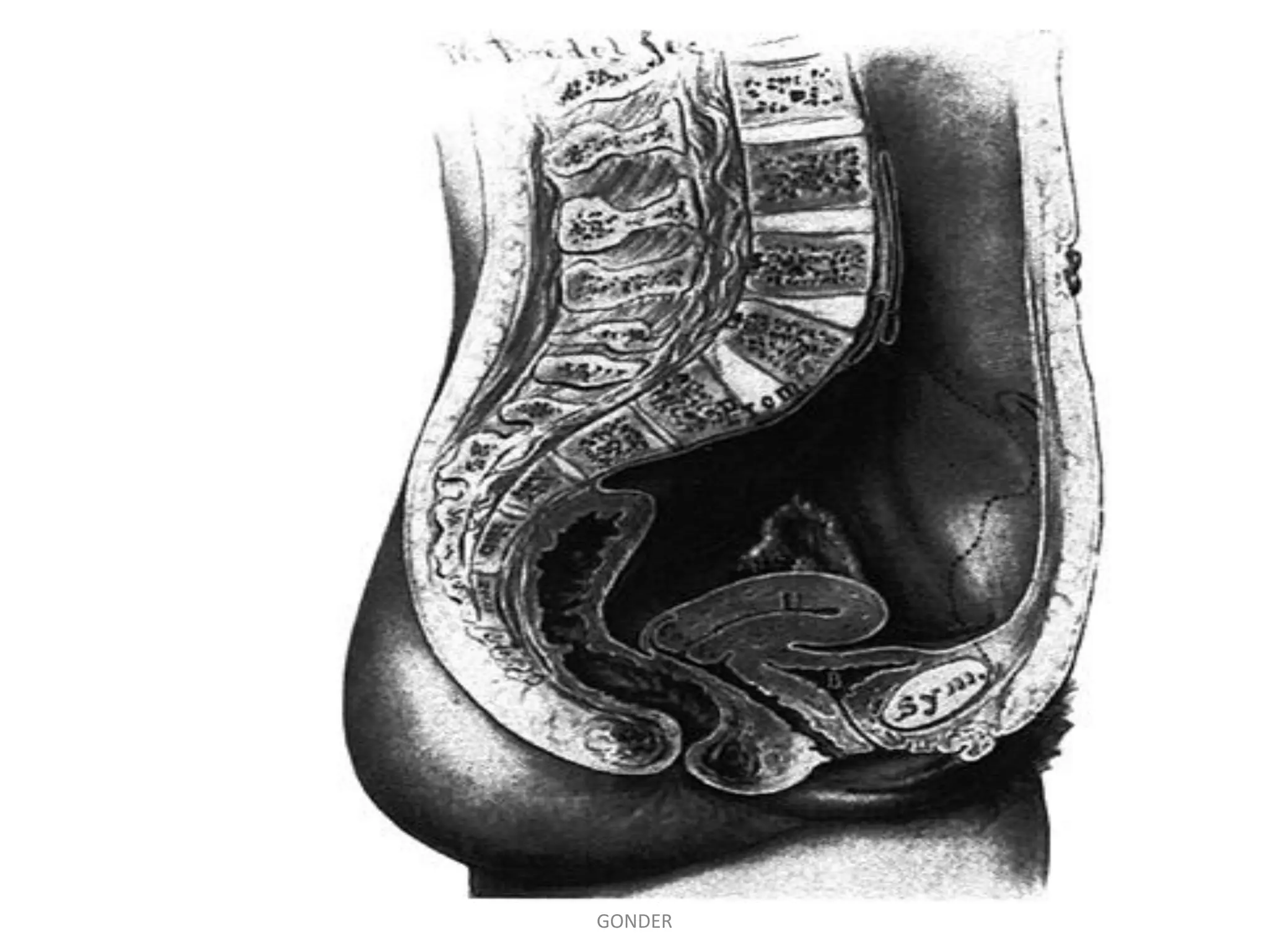 SAMUEL BEZABIH MESKEREM 2004 EC
GONDER
 