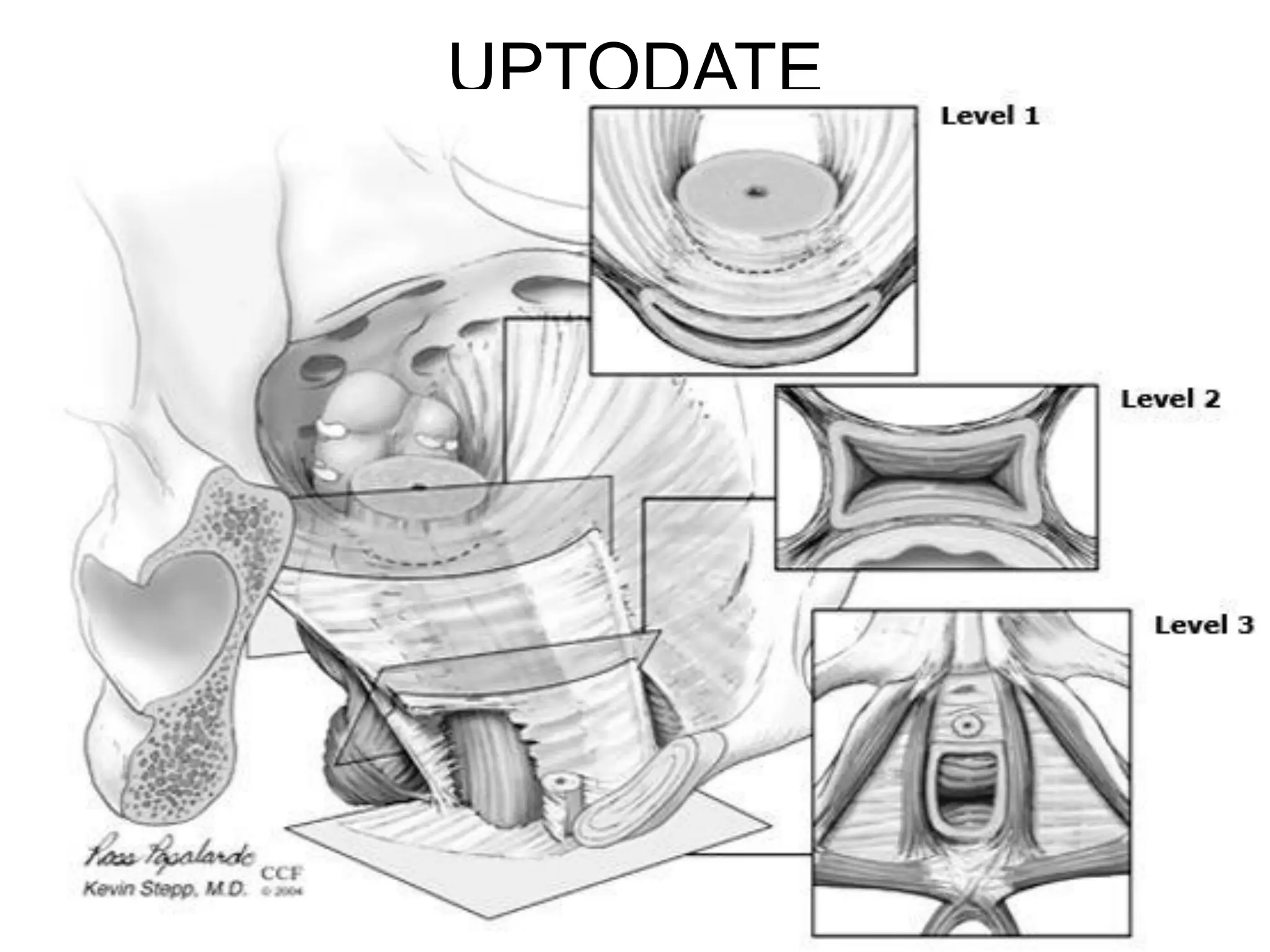 UPTODATE
SAMUEL BEZABIH MESKEREM 2004 EC
GONDER
 