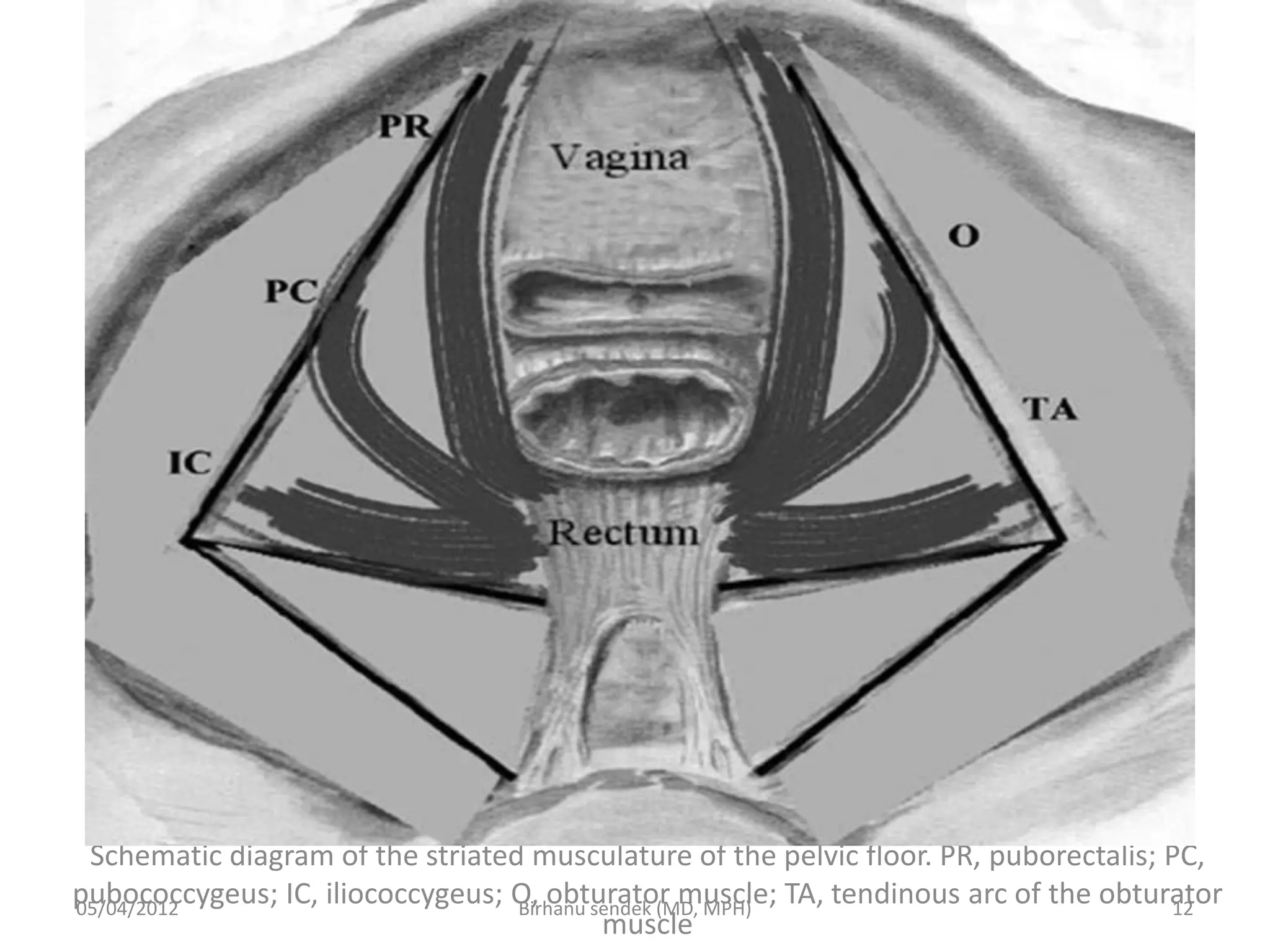 Schematic diagram of the striated musculature of the pelvic floor. PR, puborectalis; PC,
pubococcygeus; IC, iliococcygeus; O, obturator muscle; TA, tendinous arc of the obturator
muscle
05/04/2012 12
Birhanu sendek (MD, MPH)
 