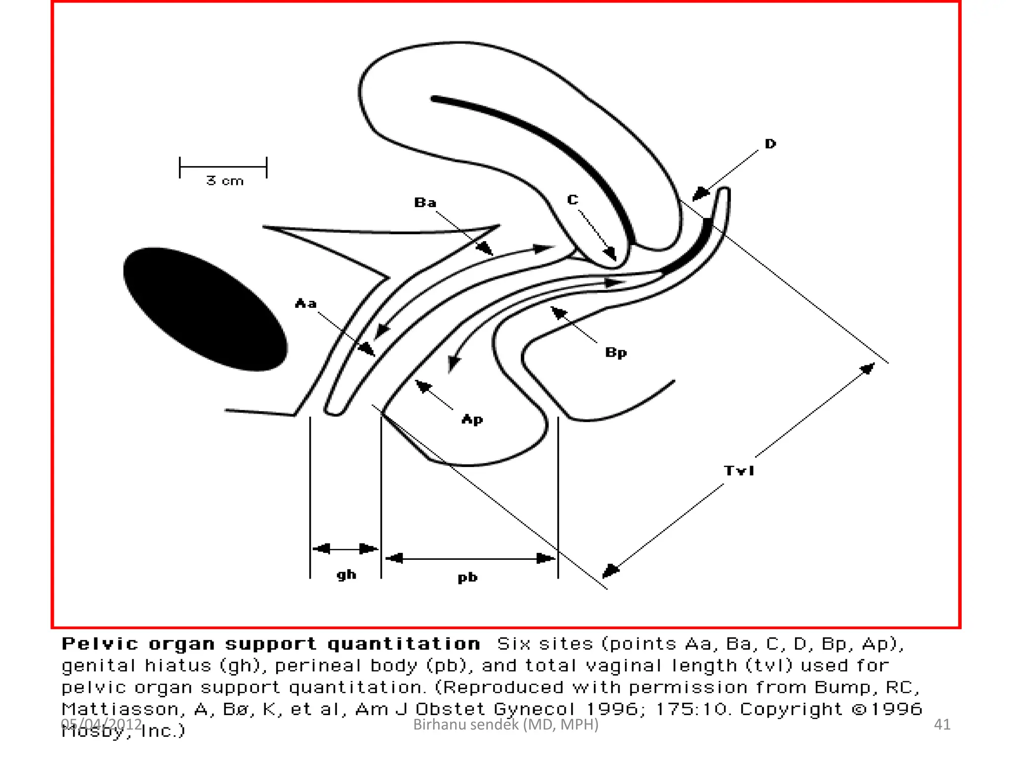 05/04/2012 41
Birhanu sendek (MD, MPH)
 
