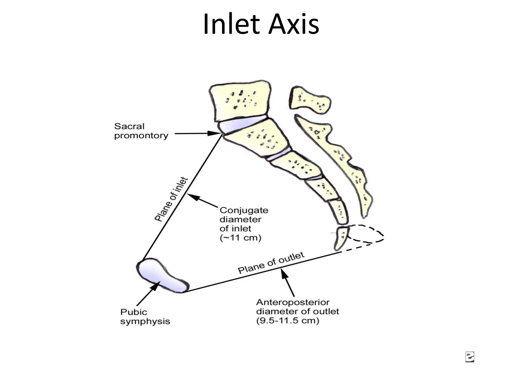Inlet Axis
 