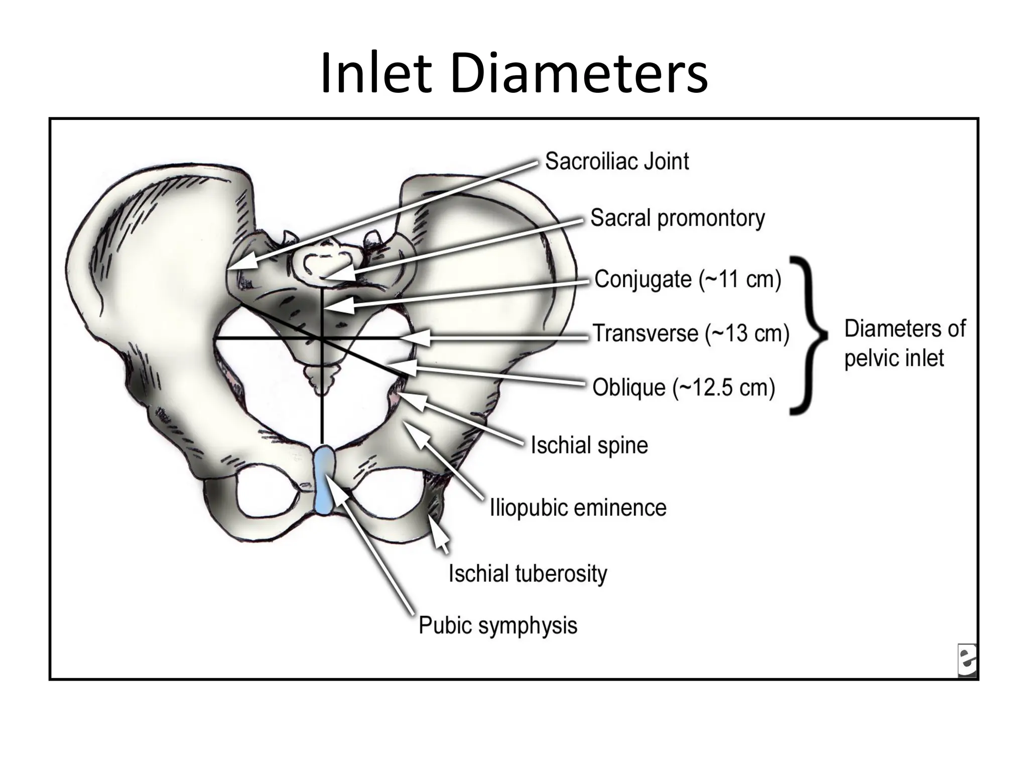Inlet Diameters
 
