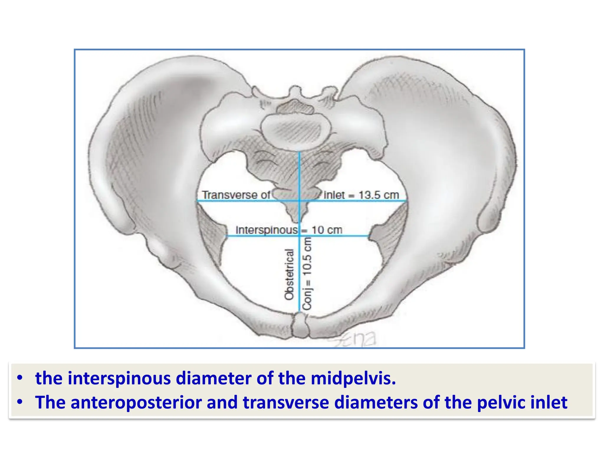 • the interspinous diameter of the midpelvis.
• The anteroposterior and transverse diameters of the pelvic inlet
 