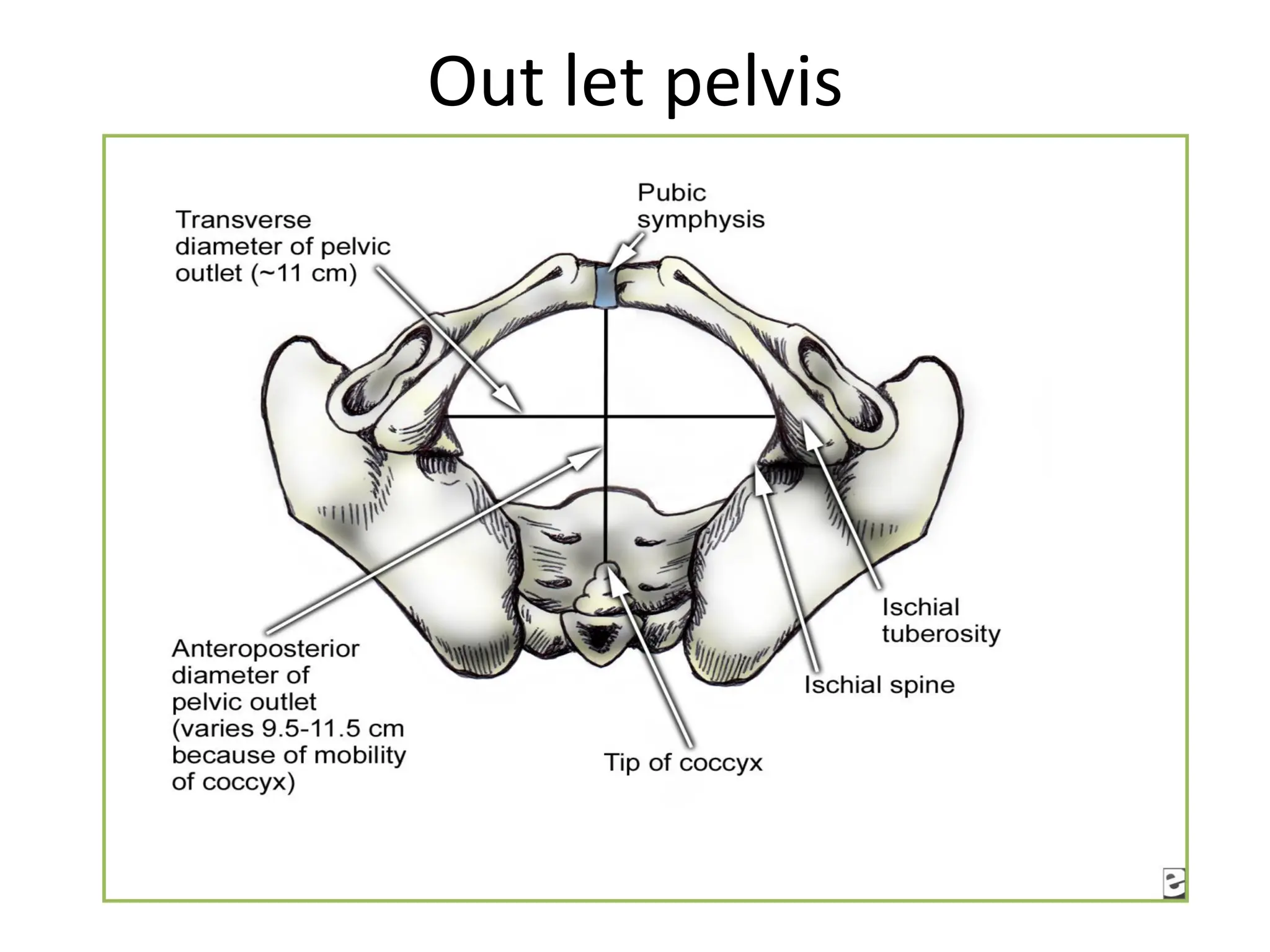 Out let pelvis
 