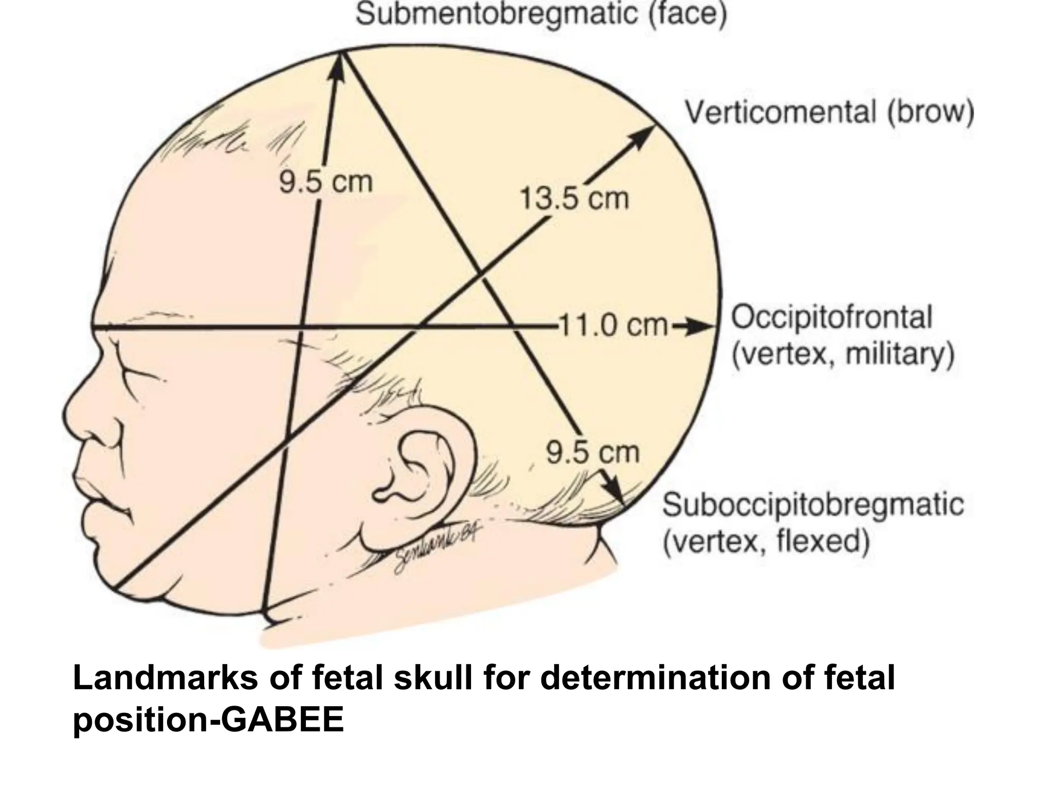 Landmarks of fetal skull for determination of fetal
position-GABEE
 