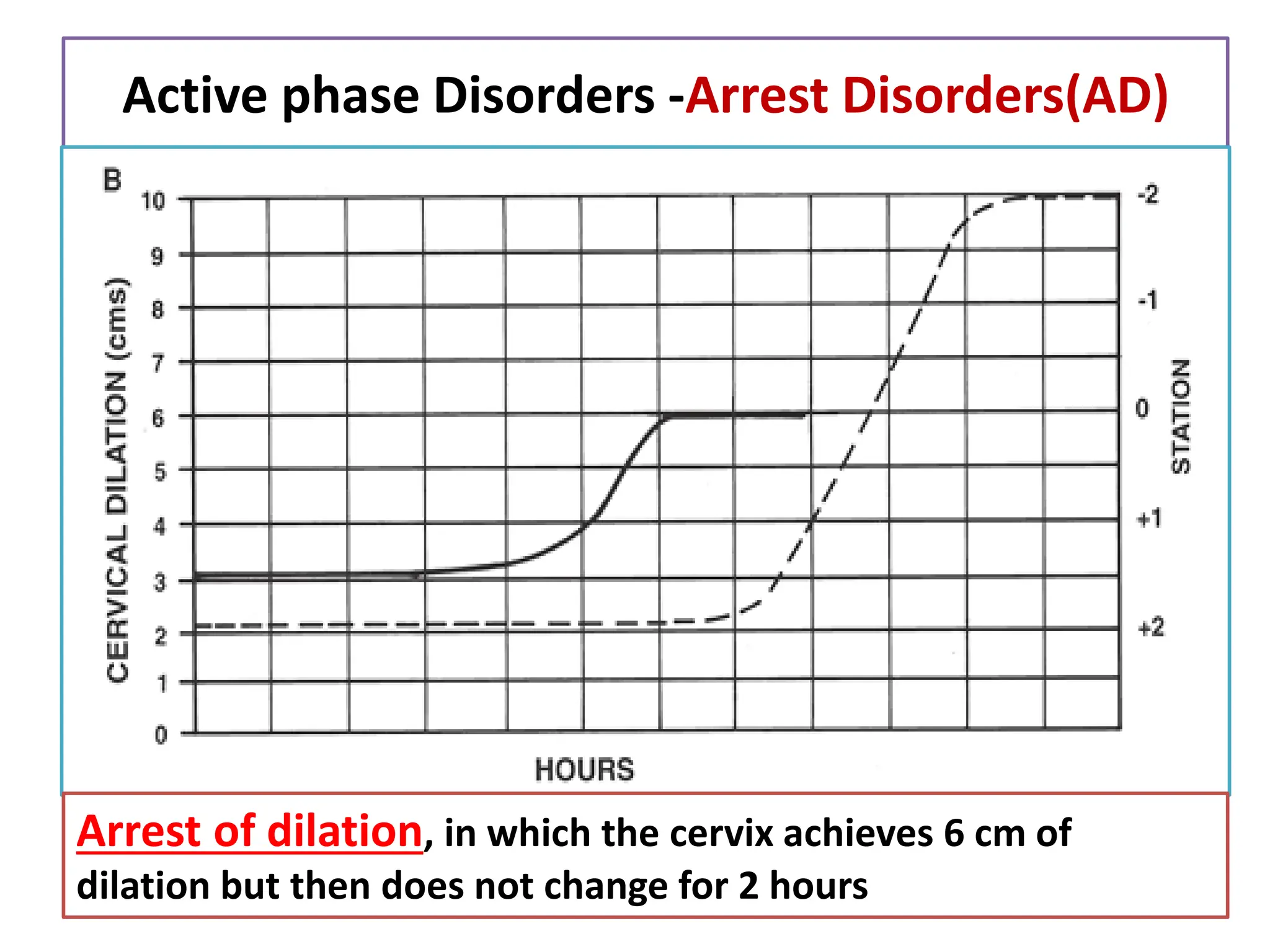 Active phase Disorders -Arrest Disorders(AD)
Arrest of dilation, in which the cervix achieves 6 cm of
dilation but then does not change for 2 hours
 