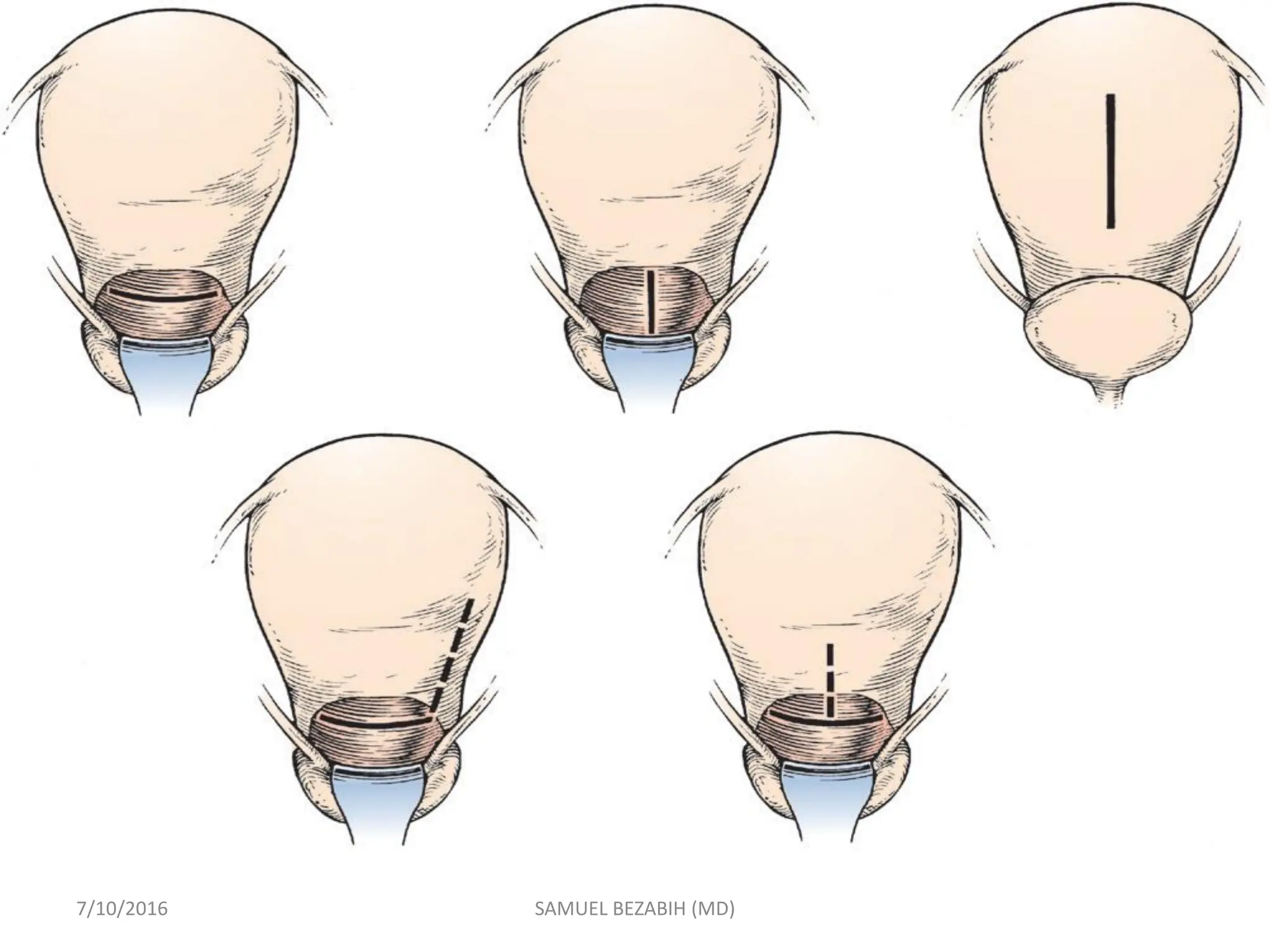 7/10/2016 SAMUEL BEZABIH (MD)
 