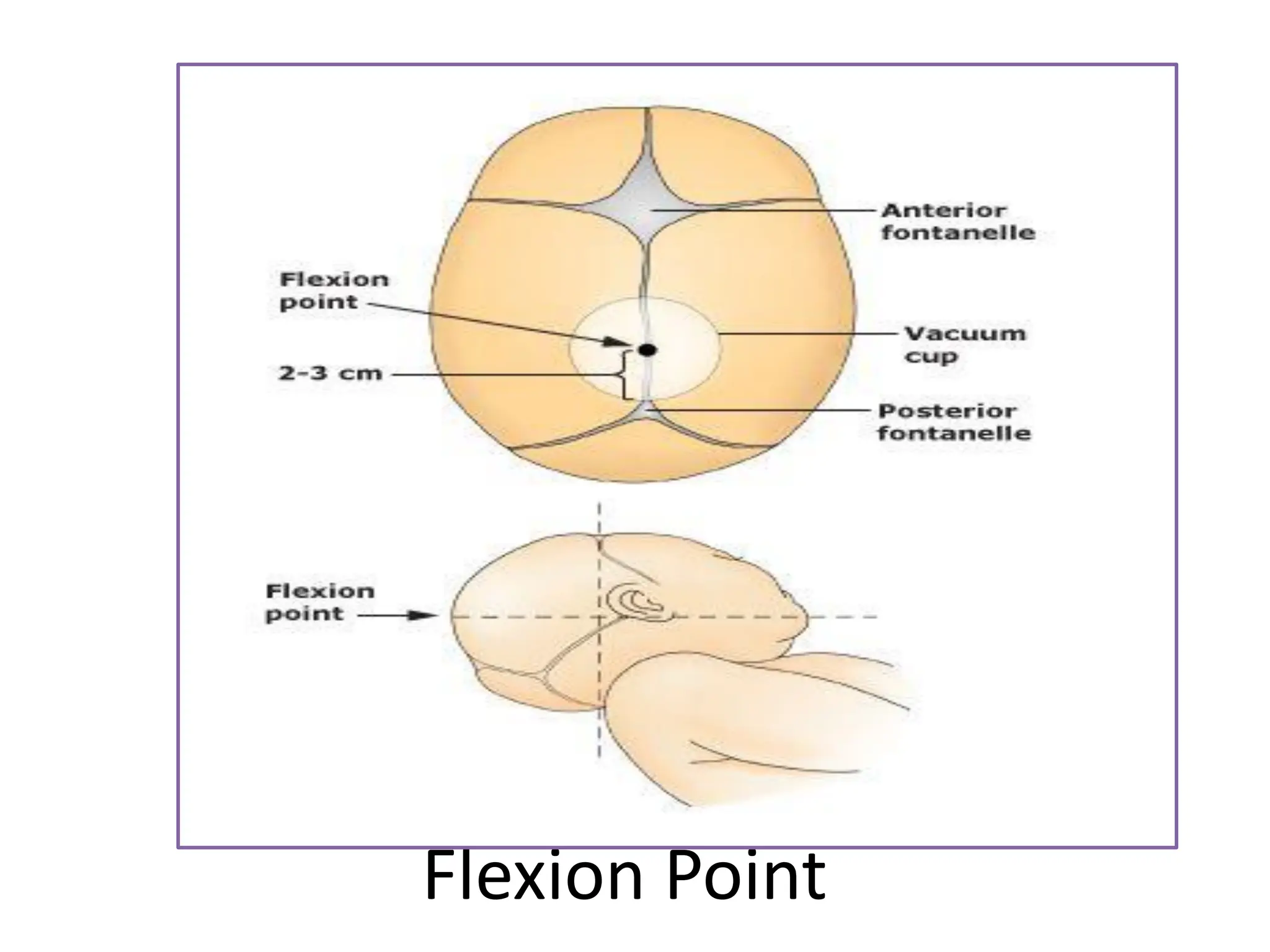 Flexion Point
 
