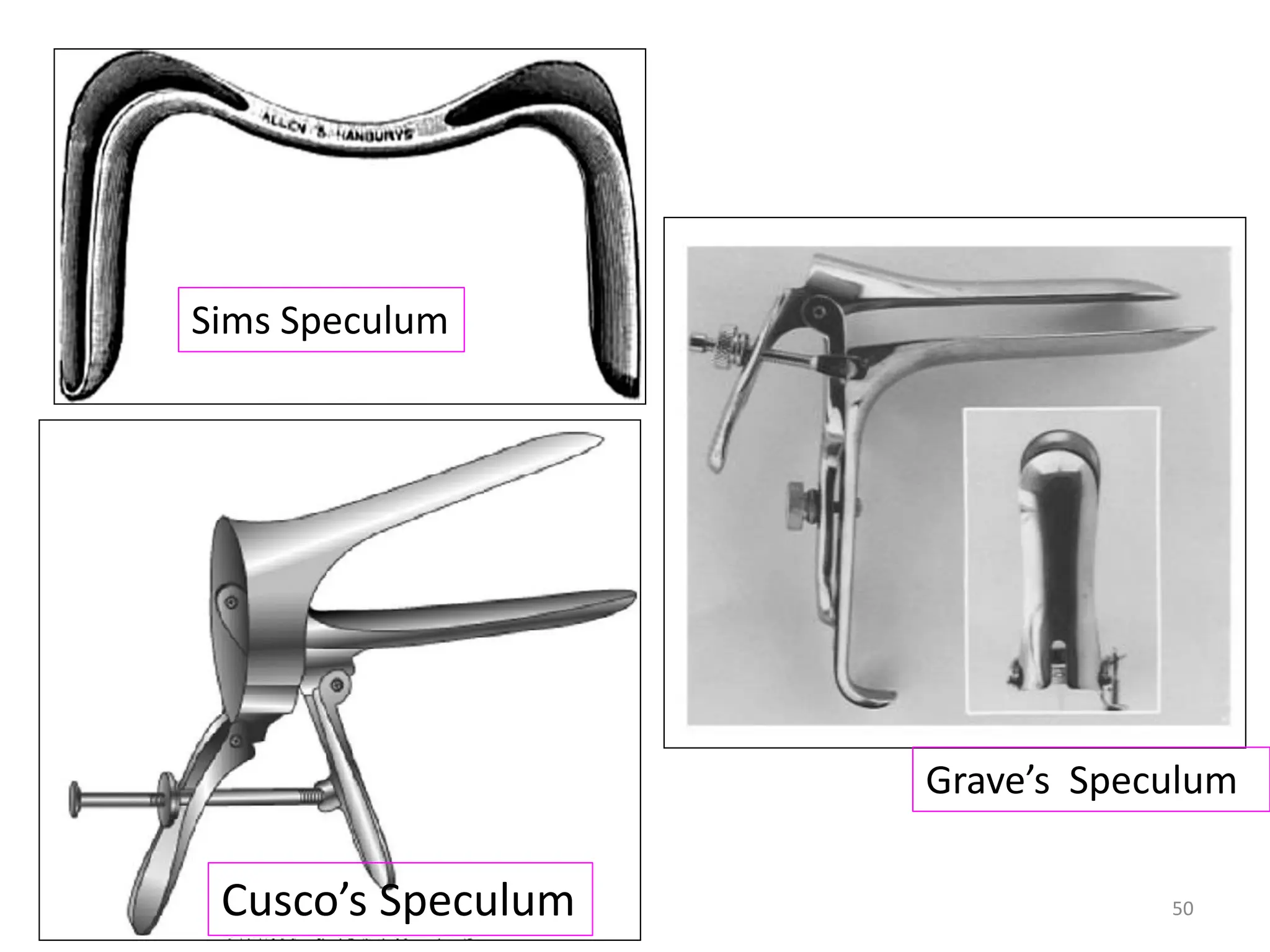 Grave’s Speculum
Sims Speculum
Cusco’s Speculum 50
 